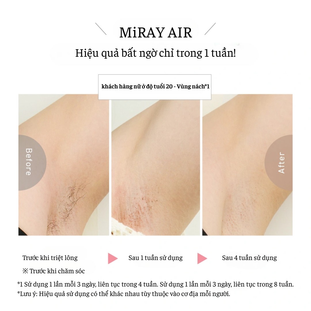 MYTREX MiRAY AIR - Thiết Bị Làm Đẹp Bằng Ánh Sáng Không Dây 9